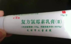 股癣用什么药膏效果最好,盘点最有效的抗真菌药物